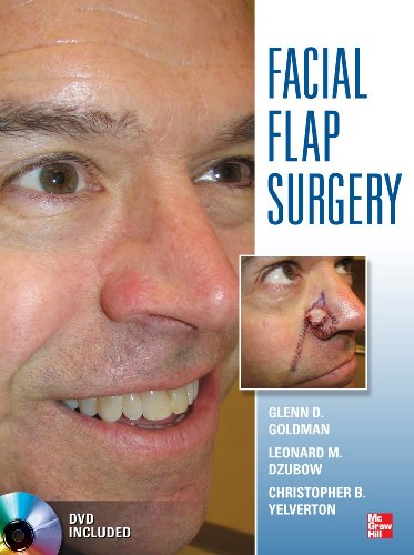 FACIAL FLAPS SURGERY