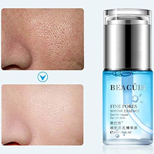 blackhead remover for sensitive skin