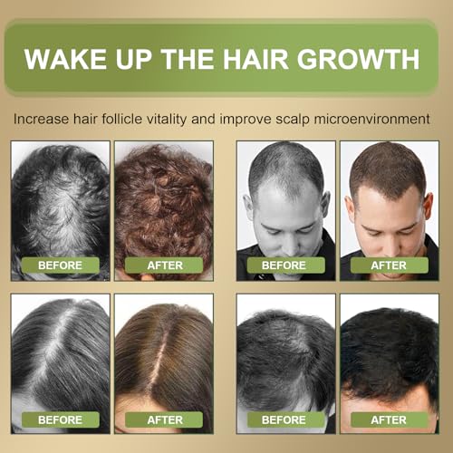 60ml Rosemary Oil for Hair, Hair Growth Oil, Scalp Care Oil, Stimulates Growth for Women and Men, Green