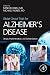Global Clinical Trials for Alzheimer's Disease: Design, Implementation, and Standardization by Menghis Bairu, Michael Weiner