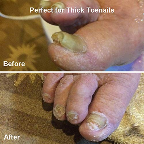 Large Toenail Clipper Cutter for Thick Toe Nails Men Seniors Elderly Stainless Steel,Ingrown Toenail Tool Nipper Wide Opening Professional Podiatrist with Lifter for Diabetic Tough Nails Curved Blades - Thumbnail 7