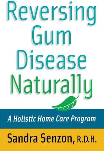 Download Reversing Gum Disease Naturally: A Holistic Home Care Program (English Edition) PDF