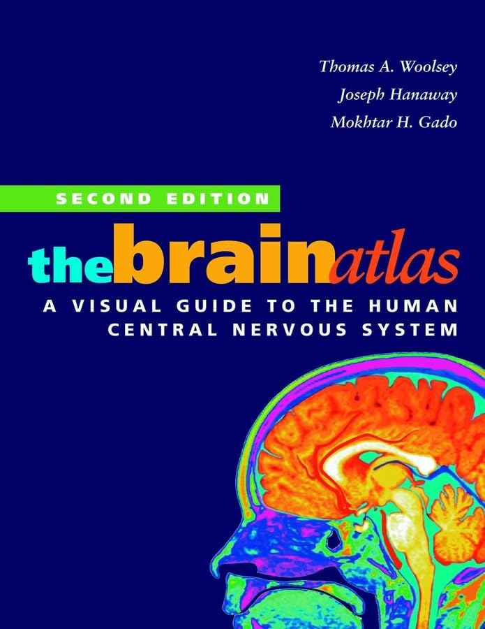 Atlas of the Human Brain: 9780128028001: Medicine & Health Science