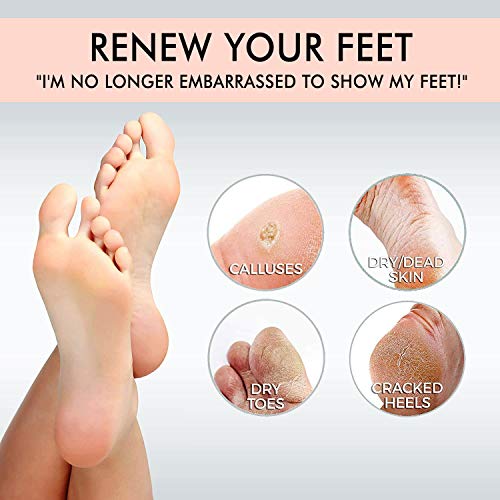 Foot Peel Mask- Deeply Exfoliates and Peels Away the Dead Skin, Cracks & Calluses,repairs rough heels revealing baby soft feet-Pack of 2 Pairs of Plastic Foot Mask for Men and Women (Lavender)