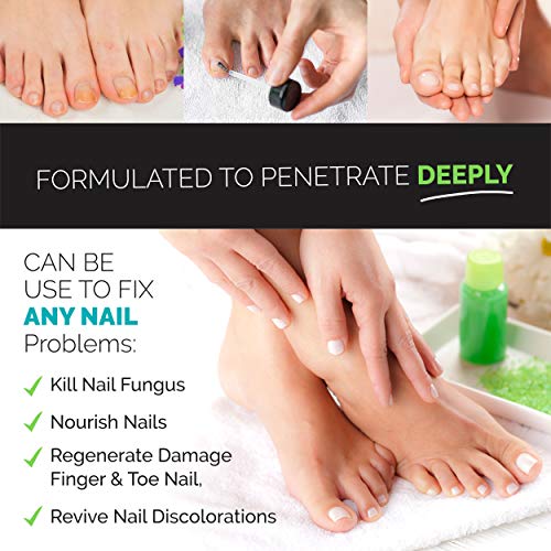 6 Best+Antifungal+Nail+Treatment+Fingernail