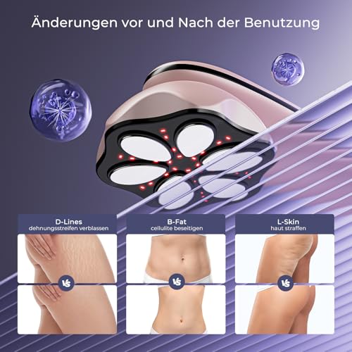 Oranmagic Cellulite Massager Anti Lipedema Hand Massager, Proven Effectiveness, with 6 Massage Heads, Suitable for Abdomen, Waist, Arms, Legs, Buttocks (Rose Gold)
