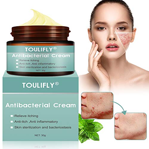 Eczema Cream Psoriasis Cream Rash Cream Antibacterial Cream Anti Itch