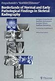 Borderlands of Normal and Early Pathologic Findings in Skeletal Radiograph, Freyschmidt, Jürgen and Brossmann, Joachim, 3137841054