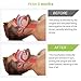 Silent Sleep Anti Snoring Device - Snoring Solution, Stop Snoring Mouthpiece - Sleep Aid Night Mouth Guard Snore Stopper - Dental Guard For Teeth Grinding, Bruxism and Comfortable Natural Sleep