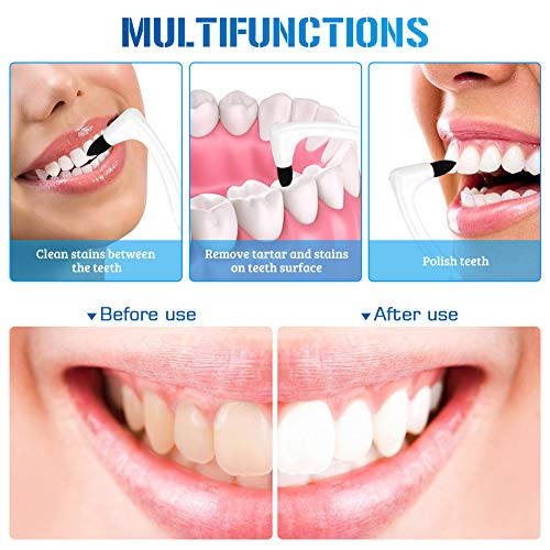 Teeth Stain Remover,Tooth Stain Plaque Remover Dental Tool Kit for Teeth Whitening Polishing,2