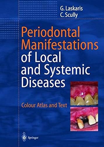 Download Periodontal Manifestations of Local and Systemic Diseases: Colour Atlas and Text PDF