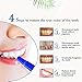 Teeth Whitening Pen,Natural Teeth Whitening Gel,Teeth Whitening Kit,Effective,Painless,Professionally Formulated & Smart Whitening,Beautiful White Smile,(2pc)