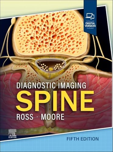 Diagnostic Imaging: Brain: 9780443380198: Medicine & Health