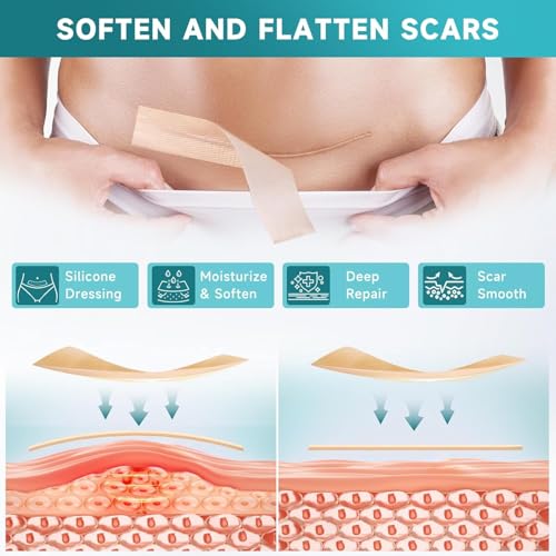 Silicone Scar Dressing 4 cm x 300 cm, Reusable Self Adhesive Silicone Band, Cuttable, Thin and Flexible, Comfortable for Different Body Areas