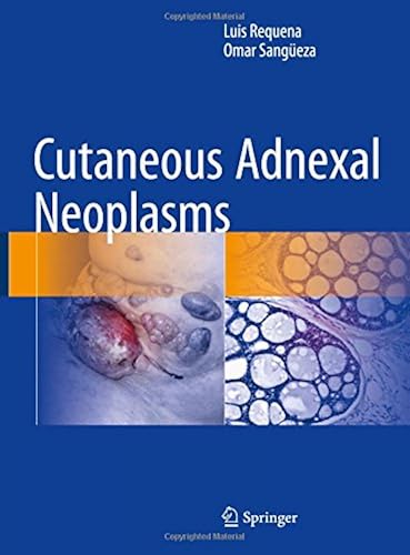 Download Cutaneous Adnexal Neoplasms PDF