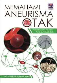 Memahami Aneurisma Otak Panduan Lengkap Bagi Pasien Dan Keluarga Indonesian Edition Tjahjadi Mardjono 9786023942268 Amazon Com Books