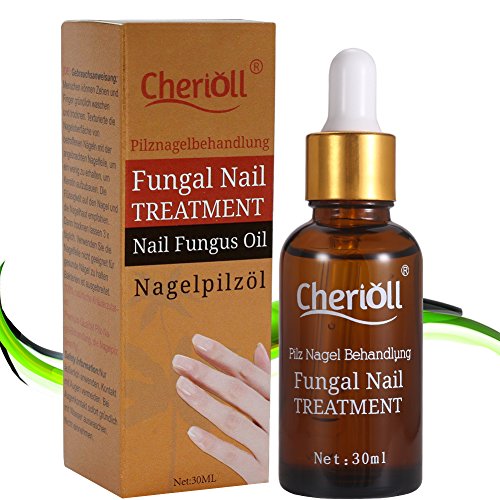 Fungal Nail Treatment,Nail Antifungal Treatment,AntiFungal Solution