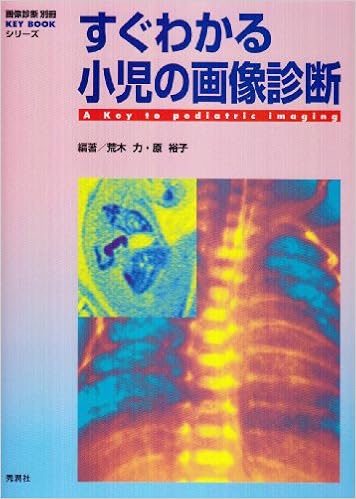本のすぐわかる小児の画像診断 (KEY BOOKシリーズ) (日本語) 単行本 – 2001/3/1の表紙