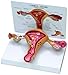 Uterus Ovary Model