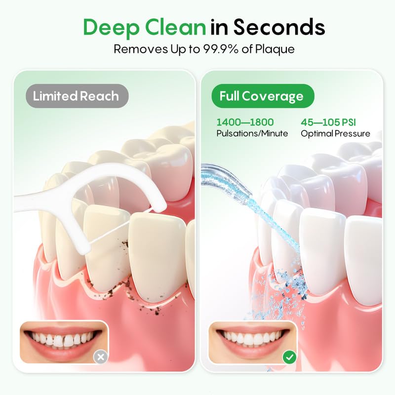 FRESKO Water Dental Flosser, 50-Day Battery Life Oral Irrigator with Constant Pressure, 300ML Water Flosser for Teeth with 5 Nozzles, IPX7 Waterproof, Ideal for Braces and Sensitive Gums