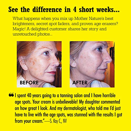 Baker S Best Age Spot And Skin Brightening Cream For Age Spots Liver Spots Freckles Face Dark Spots Eraser Remover Cream Contains Kojic Acid Green Tea Extract 2 Ounce Pricepulse