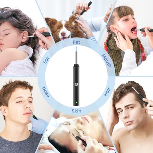 Ear Wax Removal, Ear Cleaner with 8 Pcs Ear Set, Ear Wax Removal Kit, 1296P HD Endoscope with 6 LED Lights, Kids Adults Ear Cleaning Gift, Compatible with iPhone & Android Smart Phones