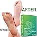 Foot Peel Mask 2 Pack for Smooth Soft Touch Feet - Peeling Away Calluses - Dead Skin Remover - Exfoliating Off Foot Mask for Baby Soft Silk Feet - Gel Socks Booties