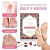 3-Pack-Foot-Peel-Mask-Foot-Peel-Mask-for-hard-skin-Remove-callus-peel-and-dead-skin-foot-mask-Foot-remover-membrane-suit-foot-peeling-mask-Peeling-Care-Rose 3 Pack Foot Peel Mask, Foot Peel Mask for hard skin, Remove callus peel and dead skin foot mask, Foot remover membrane…