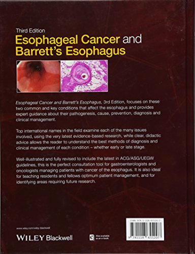 Esophageal Cancer and Barrett's Esophagus