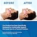 Neomen Snore Stopper Night Mouth Guard, Anti Snoring Devices, Sleep Aid Mouthpiece, Stop Snoring Guard