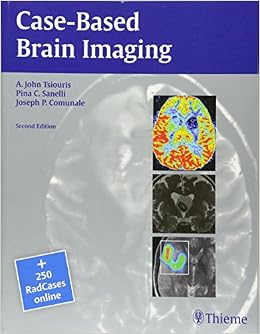 Buy Case Based Brain Imaging Radcases Book Online At Low Prices