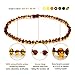 Natural Baltic Amber Teething Necklace For Babies - Anti Inflammatory, Drooling & Teething Pain Relief - Cognac Color - Polished - Unisex, 12.5 Inches, Screw Clasp, Knots - Perfect Baby Shower Gift