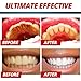 Alelife Toothpaste, Powerful Stain Removal Whitening Toothpaste Fight Bleeding Gums Toothpaste (Blueberry)