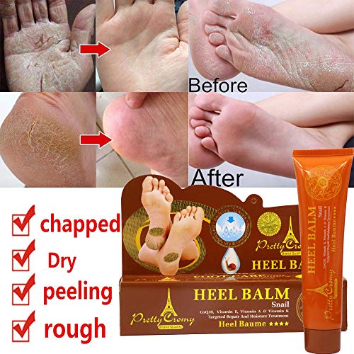 Sunshinehomely Women Hand and Foot Skin Repair, Snail Repair Cream Remove Exfoliating Feet Skin Peeling Calluses Beauty Foot Care