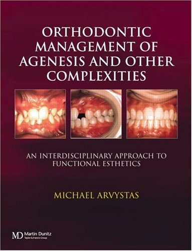 Orthodontic Management of Agenesis and Other Complexities