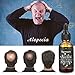 Skymore 30ml Fast Hair Growth Serum, Anti-Hair Loss, Hair Thinning Treatment, 100% Pure & Natural, Non-Greasy, Nourishing & Moisturizing, All Hair Types