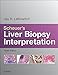 Scheuer's Liver Biopsy Interpretation E-Book