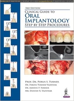 Clinical Guide to Oral Implantology: Step by Step Procedures Clinical Guide to Oral Implantology: Step by Step Procedures