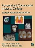 Porcelain and Composite Inlays and Onlays : Esthetic Posterior Restorations, Garber, David and Goldstein, Ronald E., 0867151714