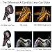 iPhone Camera Lens Kit (Universal) Pro Series HD DSLR Lens Bundle For iPhone & Samsung Galaxy + Exclusive Video Course with our Pro Photographers (Super Wide Angle .45X + Macro Lens 12.5X + 37mm Clip)