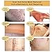 2 Pack TCM Scar and Acne Marks Removal Gel Ointment, Skin Repair Scars Burns Cuts Pregnancy Stretch Marks Acne Spots Skin Redness Treatment Cream for Face and Body (3 Pack)