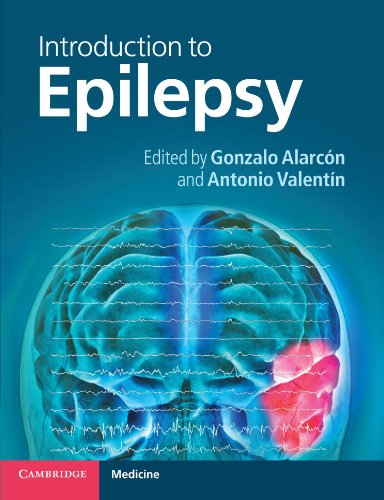 INTRODUCTION TO EPILEPSY
