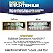 Premium Teeth Whitening Kit for Home use - Made in USA - Faster Results Than Tooth Whitening Strips, Pen and Toothpaste. Safe for Sensitive Teeth (Teeth Whitening Kit)