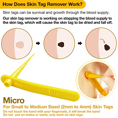 Skin Tag Remover, Micro Skin Tag Removal Kit with 36Pcs Repair Patches