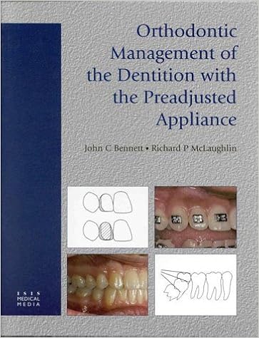 Orthodontic Management Of The Dentition With The Preadjusted - 