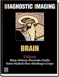 Diagnostic Imaging: Brain
