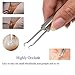 SelfTek Blackhead Extractor Stainless Steel Pimple Remover Clips Curved Facial Extractor