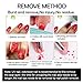 Ownest Burst Magic Nail Polish Remover, Easily & Quickly Removes Soak-Off Gel Polish, Don't Hurt Nails, Professional Non-Irritating Nail Polish Remover-15ml