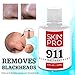 SkinPro Rapid Repair Acne Treatment | The Fastest Working (Medical Grade) Formula | Highly Concentrated Salicylic Acid Solution | Remove Acne and Blackheads Fast