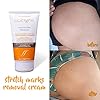 Cicatrissim Stretch Marks Removal Cream - Innovative Natural Formula With Pure and Potent Ingredients From Brazilian…
